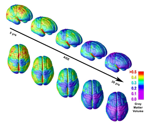 El cerebro adolescente